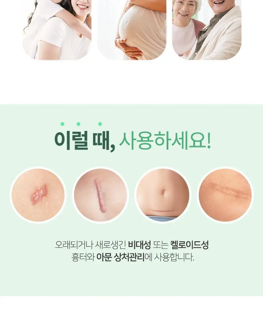 [의료기기] 시카슈어 겔 15g 상세페이지 8